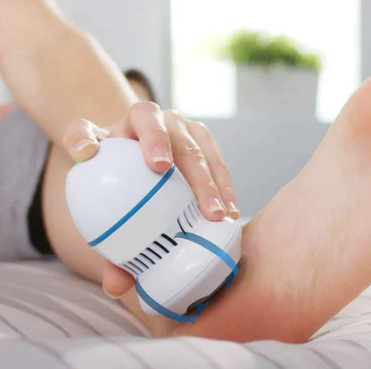 Removedor de Calos Portátil para Pés 🦶✨