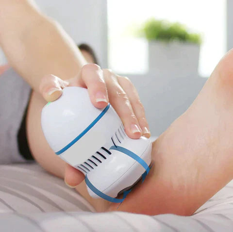 Removedor de Calos Portátil para Pés 🦶✨